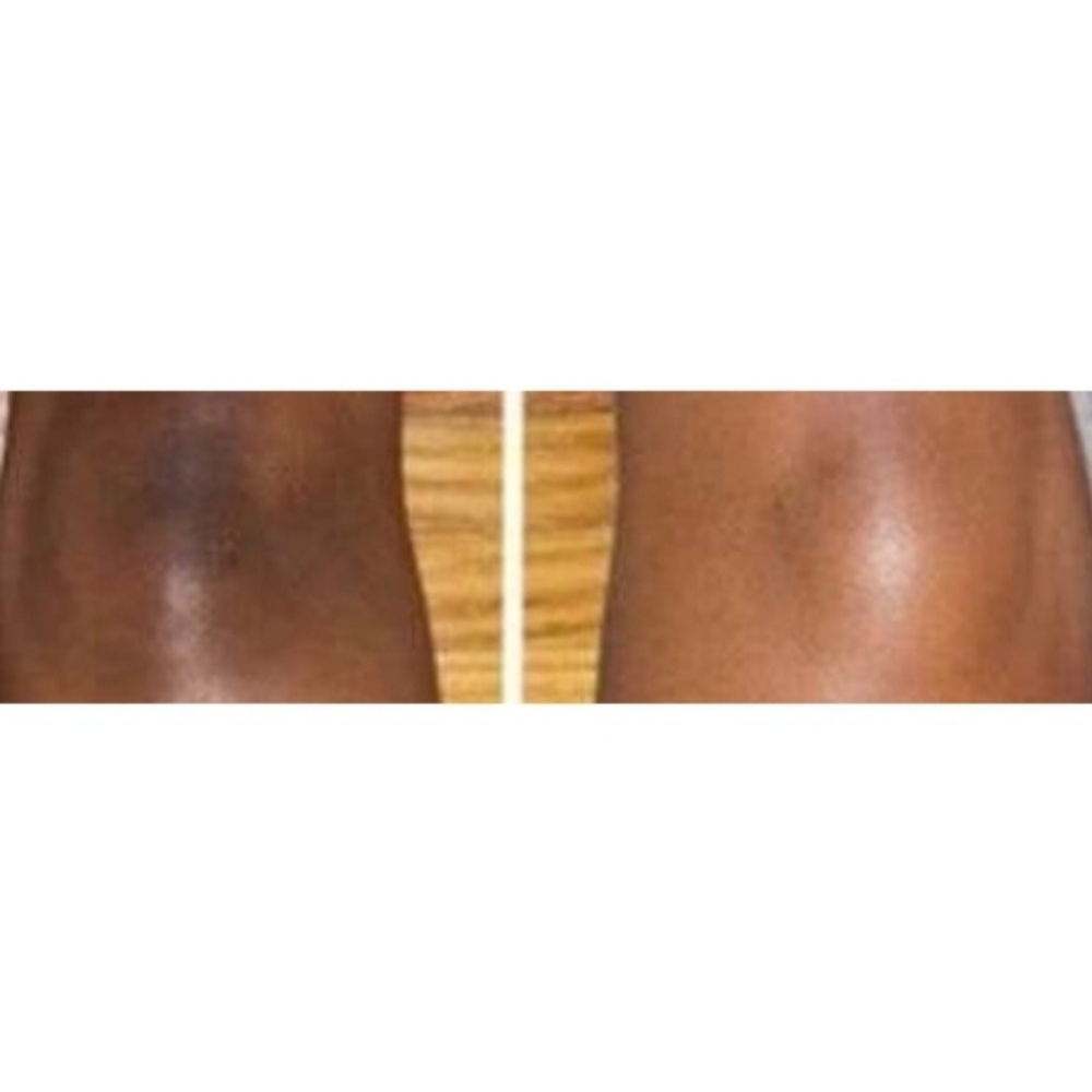 "Lighten Up" Skin Lightening Treatm at Facez By Monica in Lakewood, CA