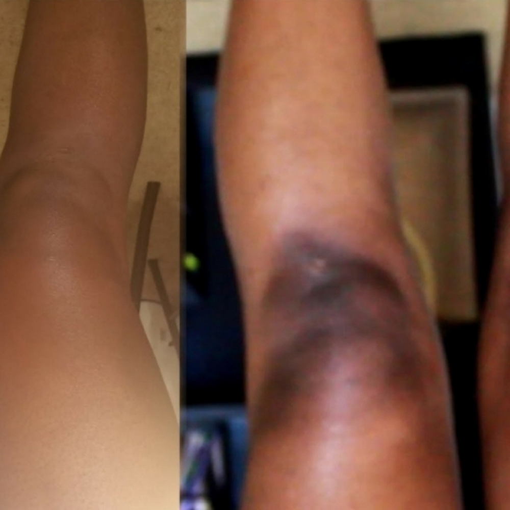 "Lighten Up" Skin Lightening Treatm at FACEZ BY MONICA in Lakewood, CA