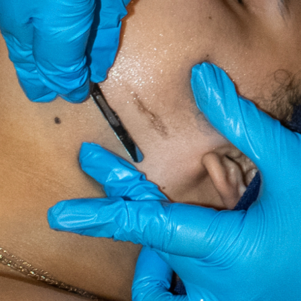 Dermaplane Add On at HP BEAUTY SUITES in Chesterfield, MI