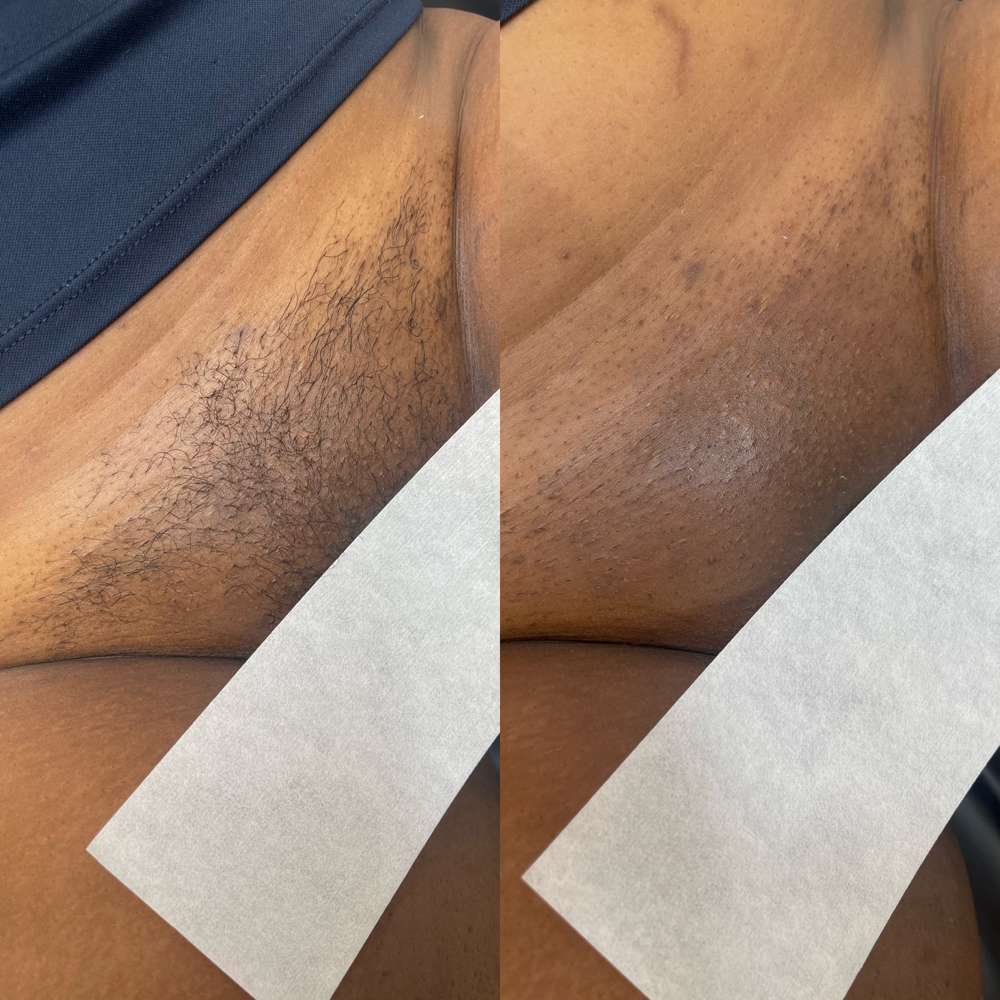 Brazilian Wax at KAYDEE'S BEAUTY BAR in Norfolk, VA
