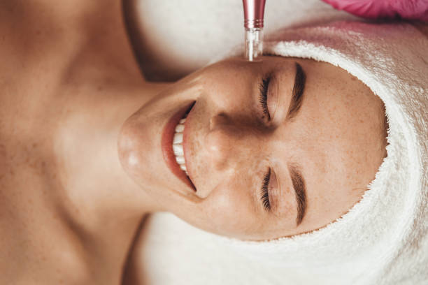 Microneedling - 1 Session