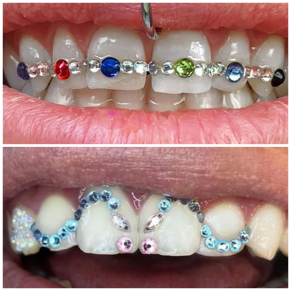 ✨💎Signature Design at 💎Kat’s Tooth Gems💎 in Martinsburg, WV
