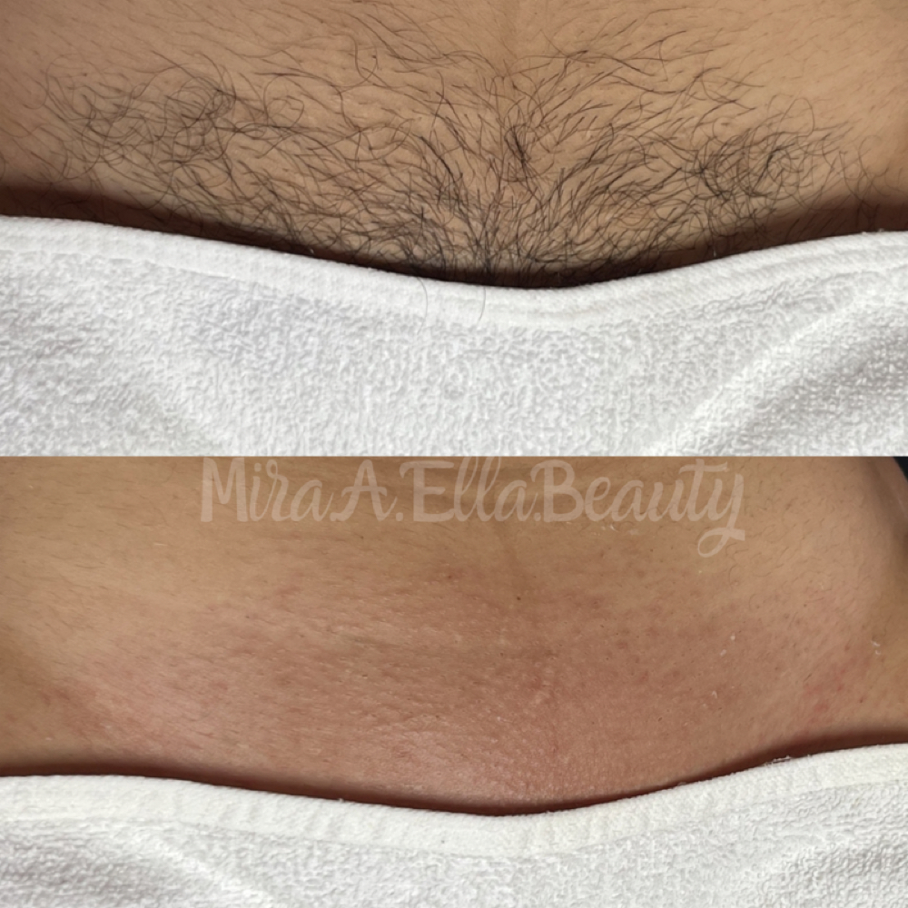 Bikini Wax at JA Beauty & Skin in Kansas City, MO