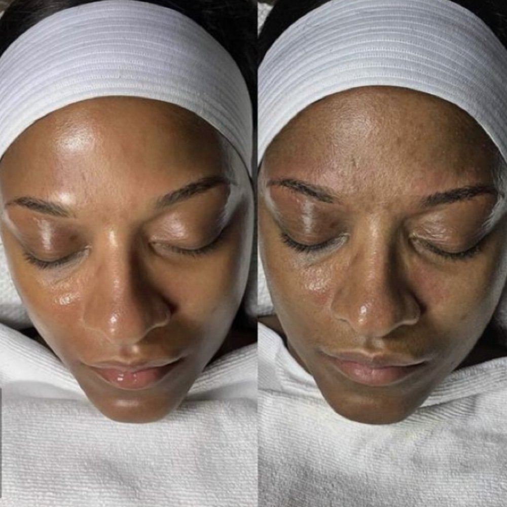 Luxe Exfoliation Facial