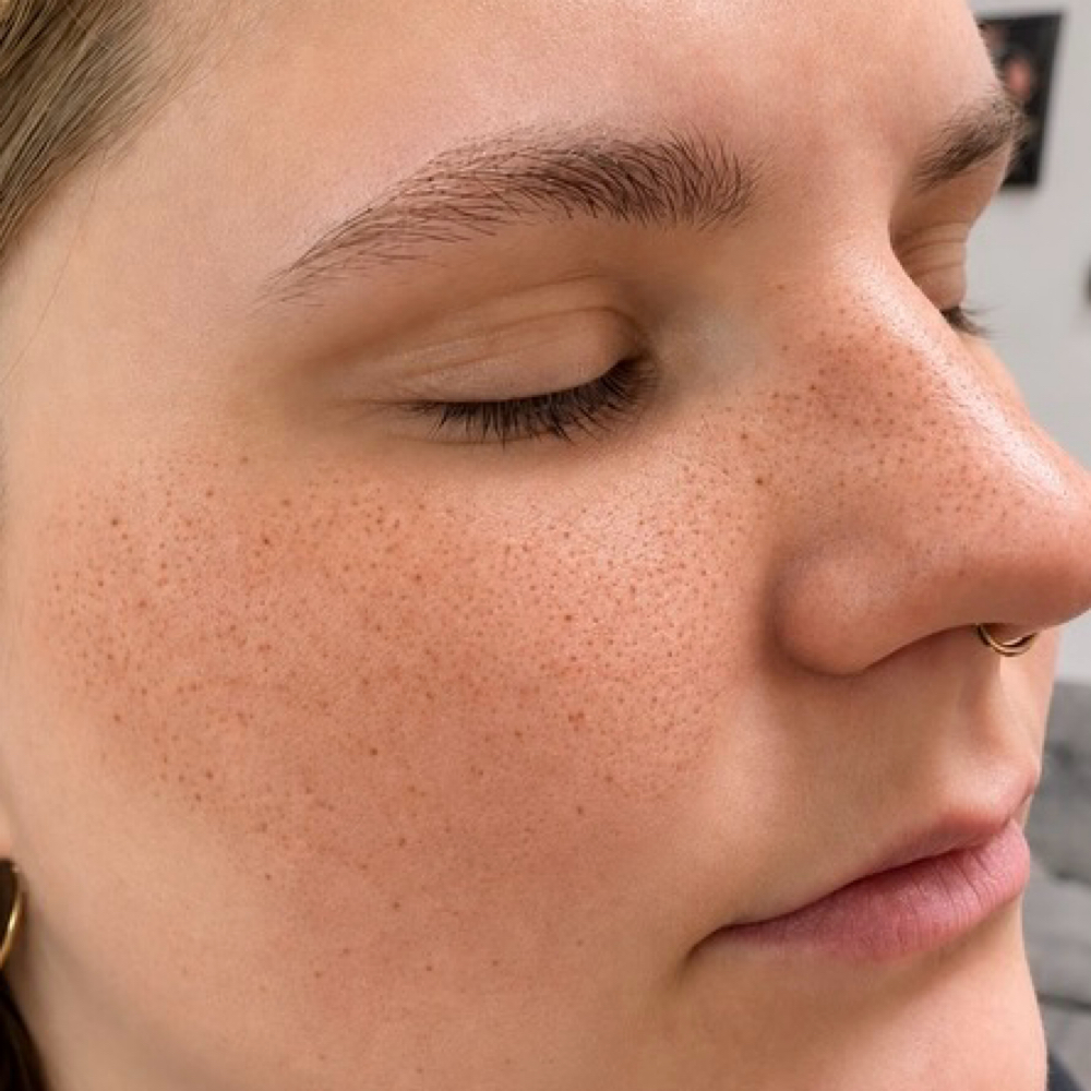 Freckles/Beauty Marks at Northern Beauty in Gaylord, MI
