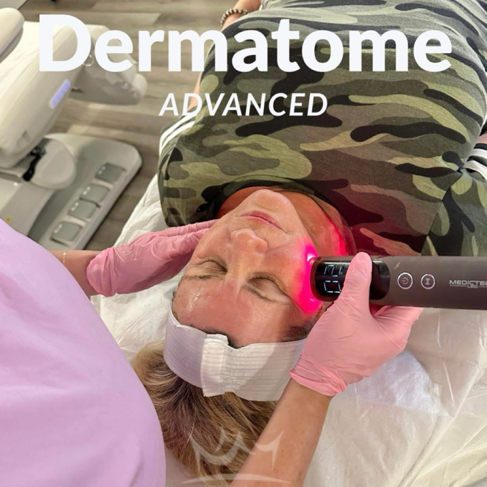 Dermatome Advanced at ARock Beauty & Wellness in San Angelo, TX