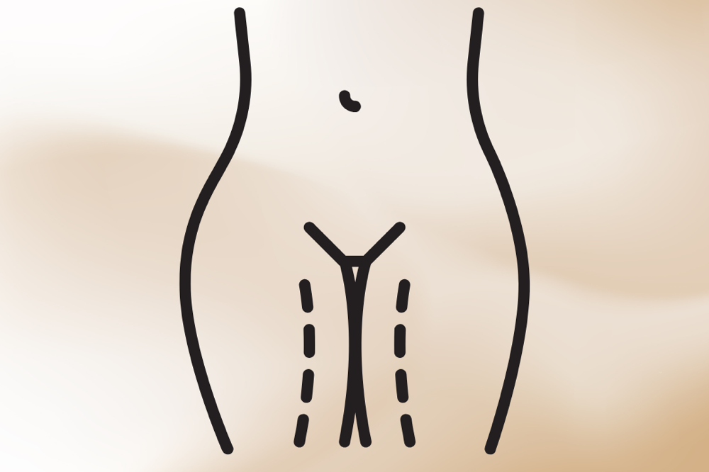 BIKINI WAX (W)