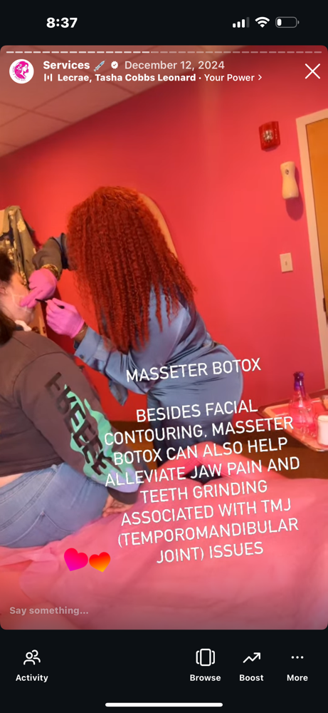 Masseter Botox