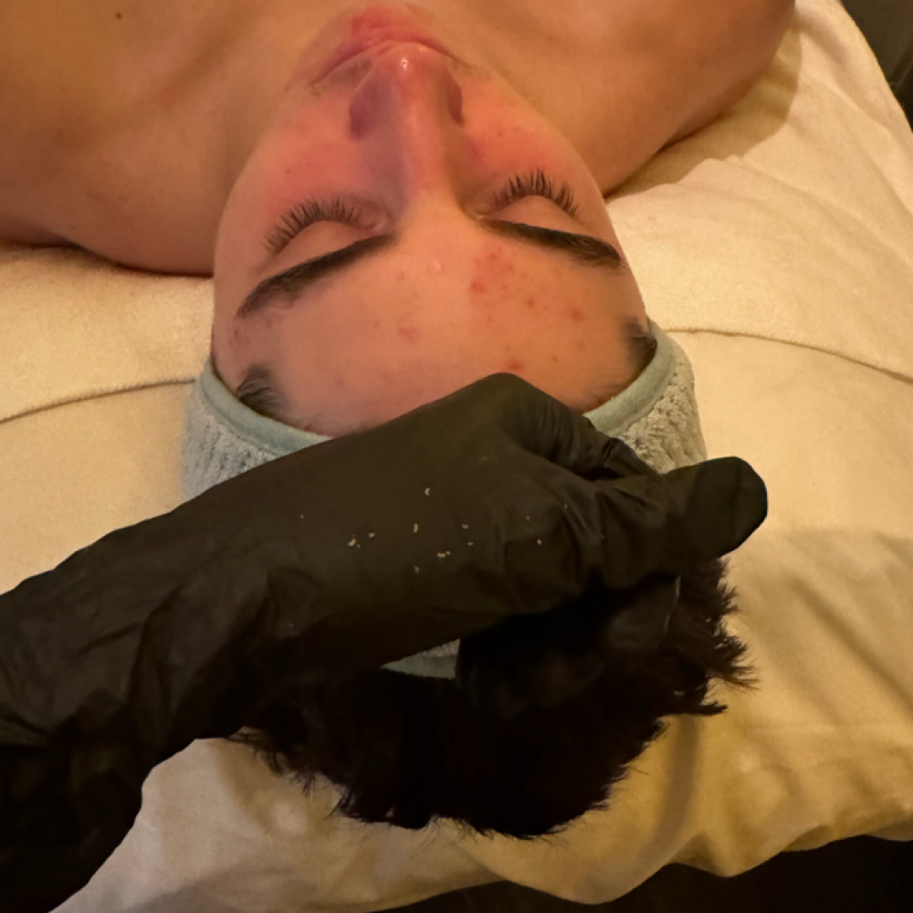 Clear Complextion Facial at Reyna Revive and Refresh in Georgetown, TX