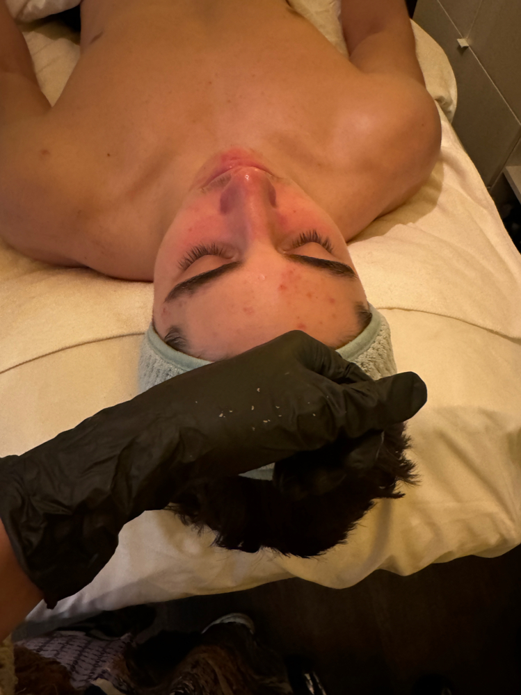 Clarifying Facial