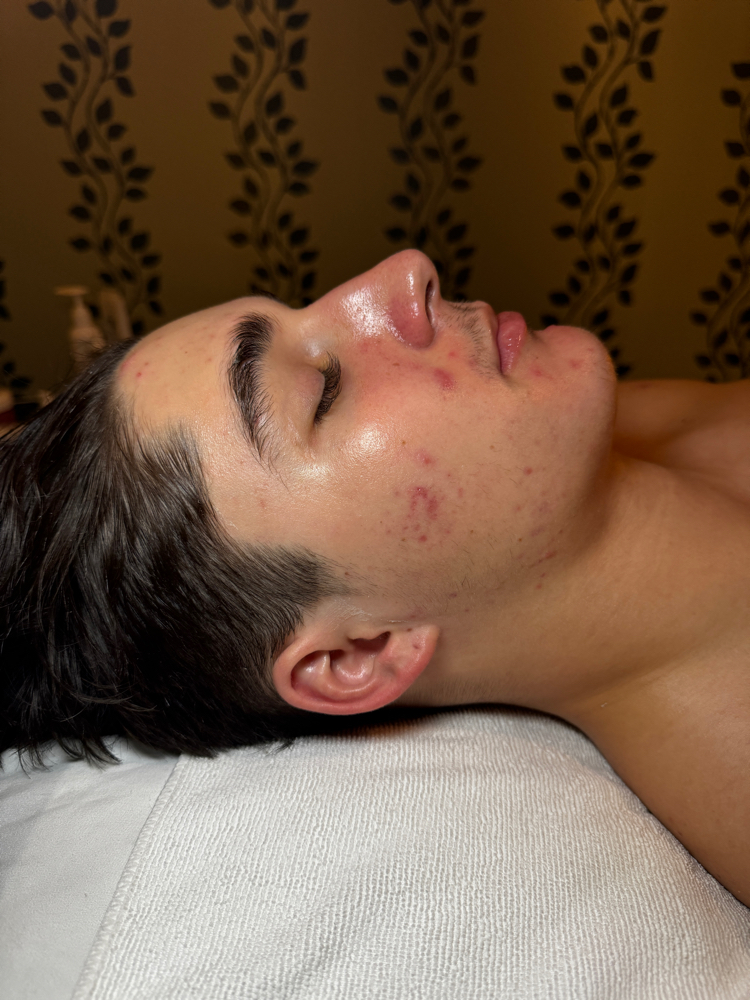 Clarifying Facial
