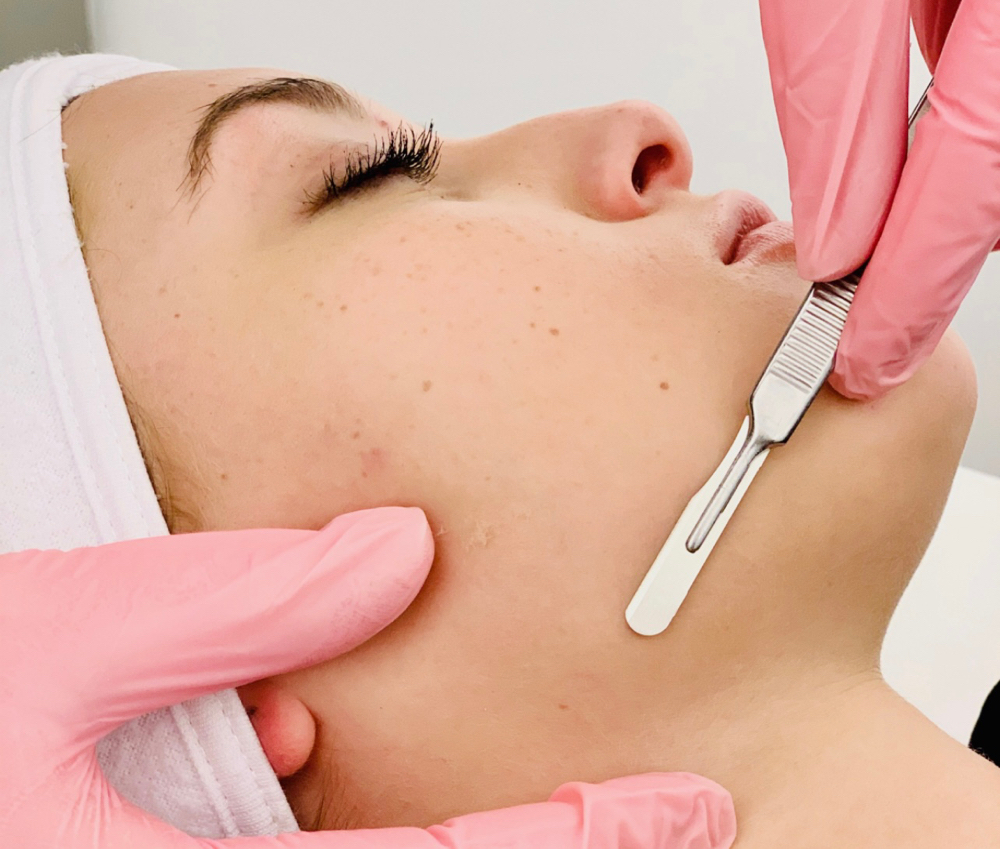 Express Dermaplane