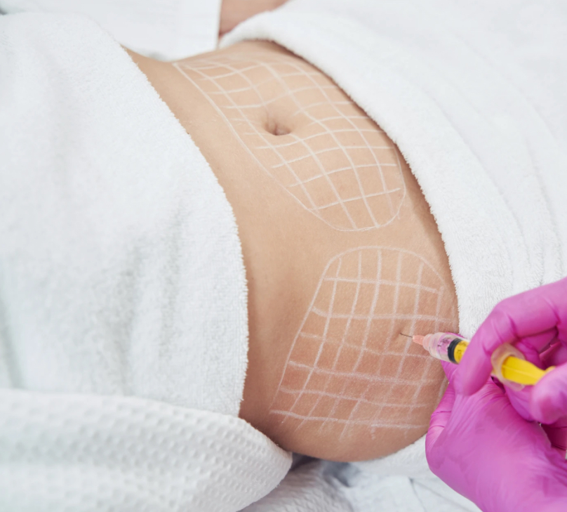 Lipo-Dissolve: Large Area