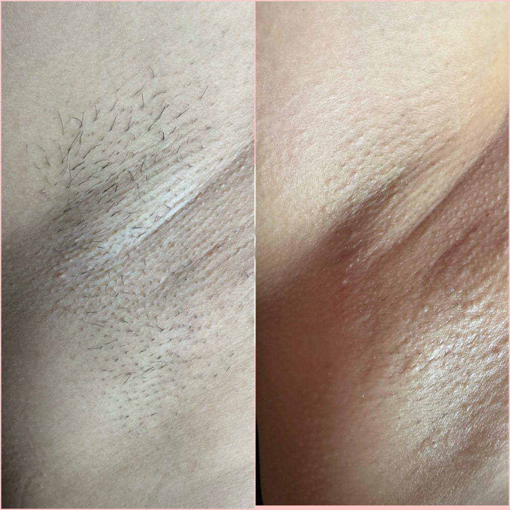 Underarm wax