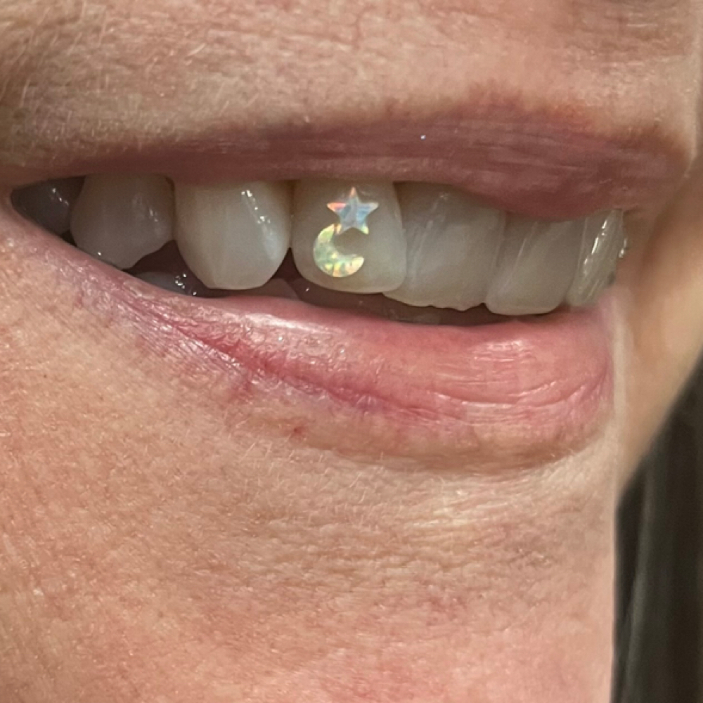 Tooth Gems at Ciera  Cheney in Salt Lake City, UT
