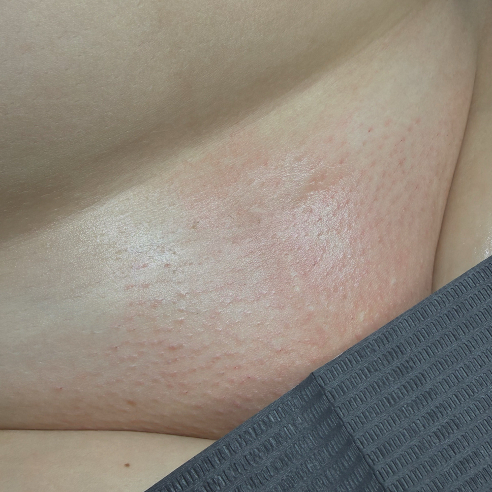 Brazilian Wax at Waxura Studio in Martinsburg, WV