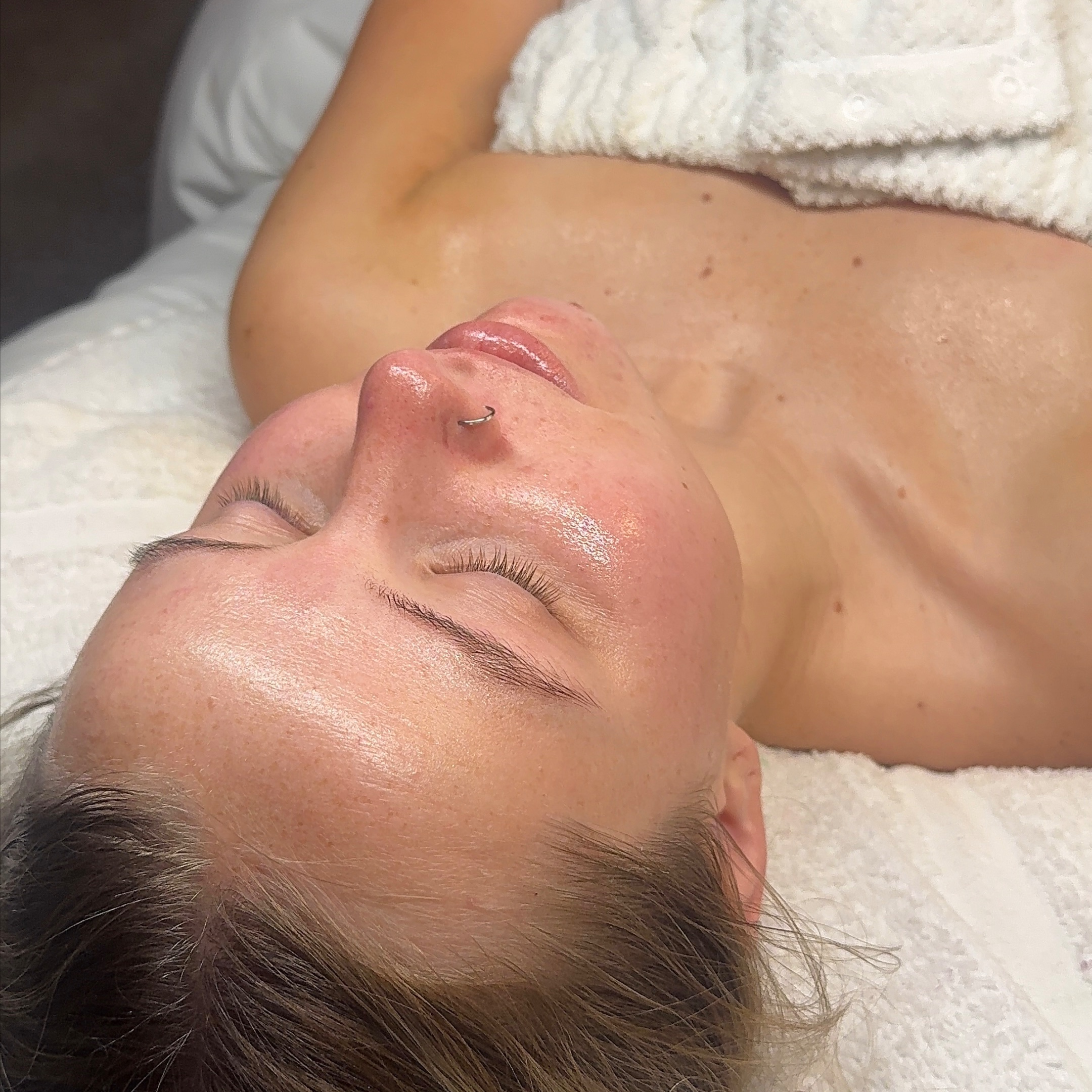 Light Chemical Peel at Glow by Allison in Grapevine, TX
