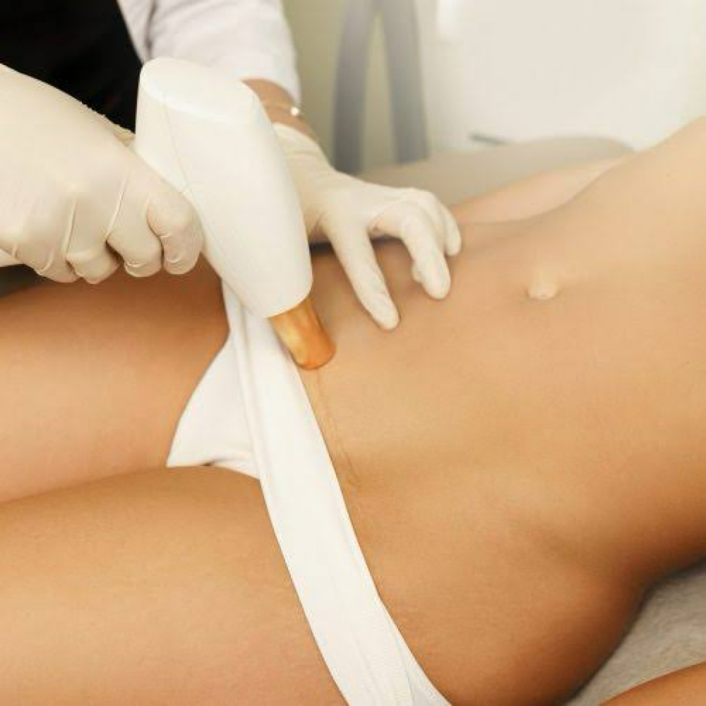 Laser Hair Removal (Brazilian ) at All Aesthetics Kare in Upland, CA