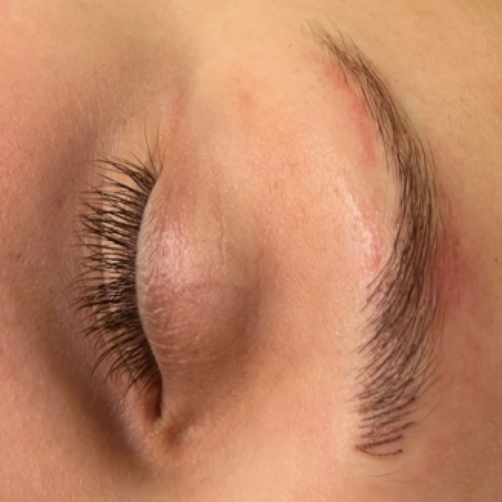 5 Week Brow Follow Up