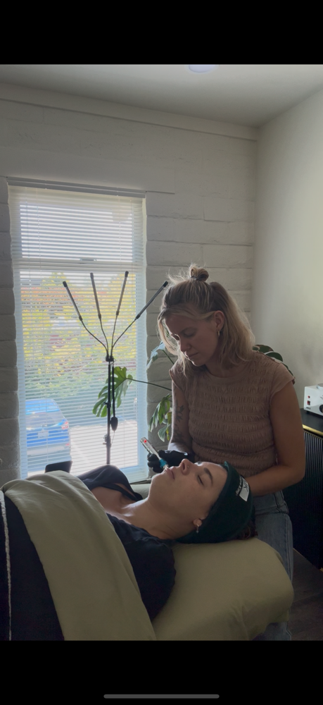 Microneedling