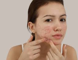 Teen Facial