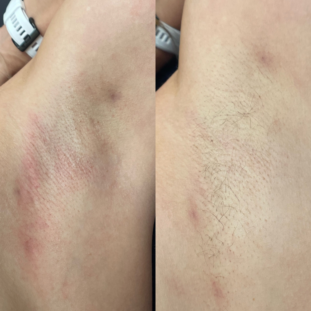 Underarm Wax