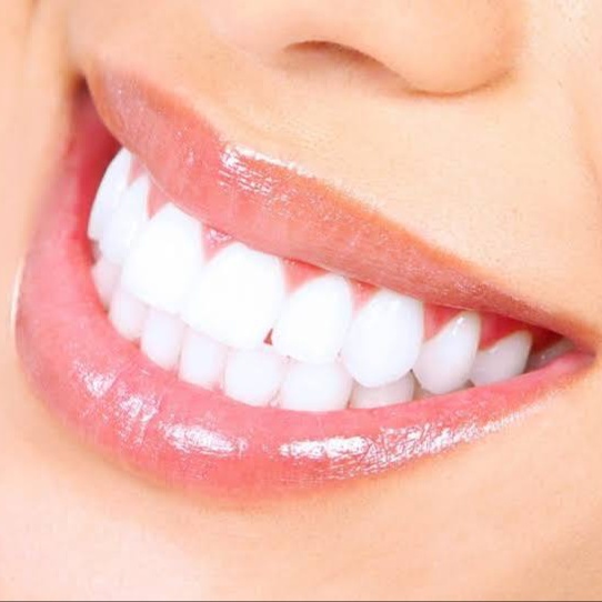 Teeth Whitening at Cabana Tan & Wellness Studio LLC in Salem Lakes, WI