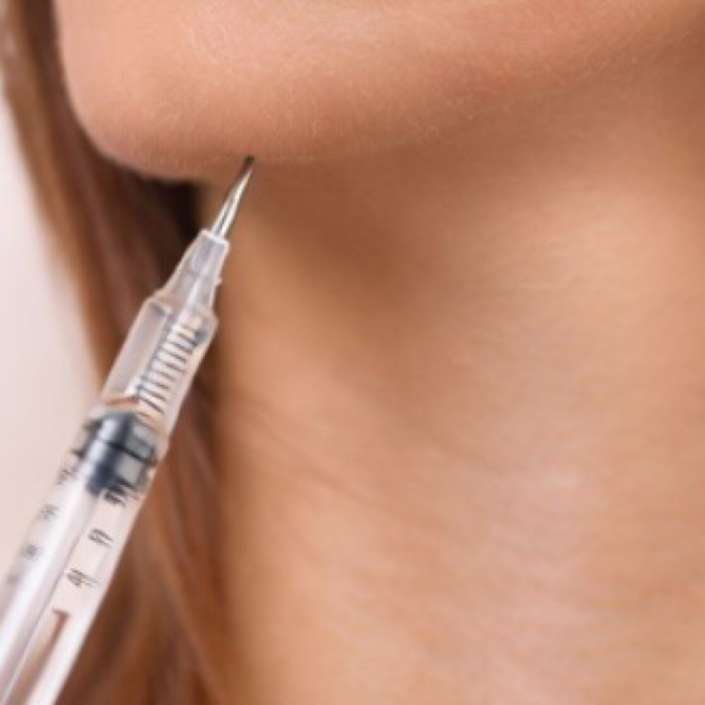 Chin Tox at Facial Focus Studio, LLC in San Juan, TX