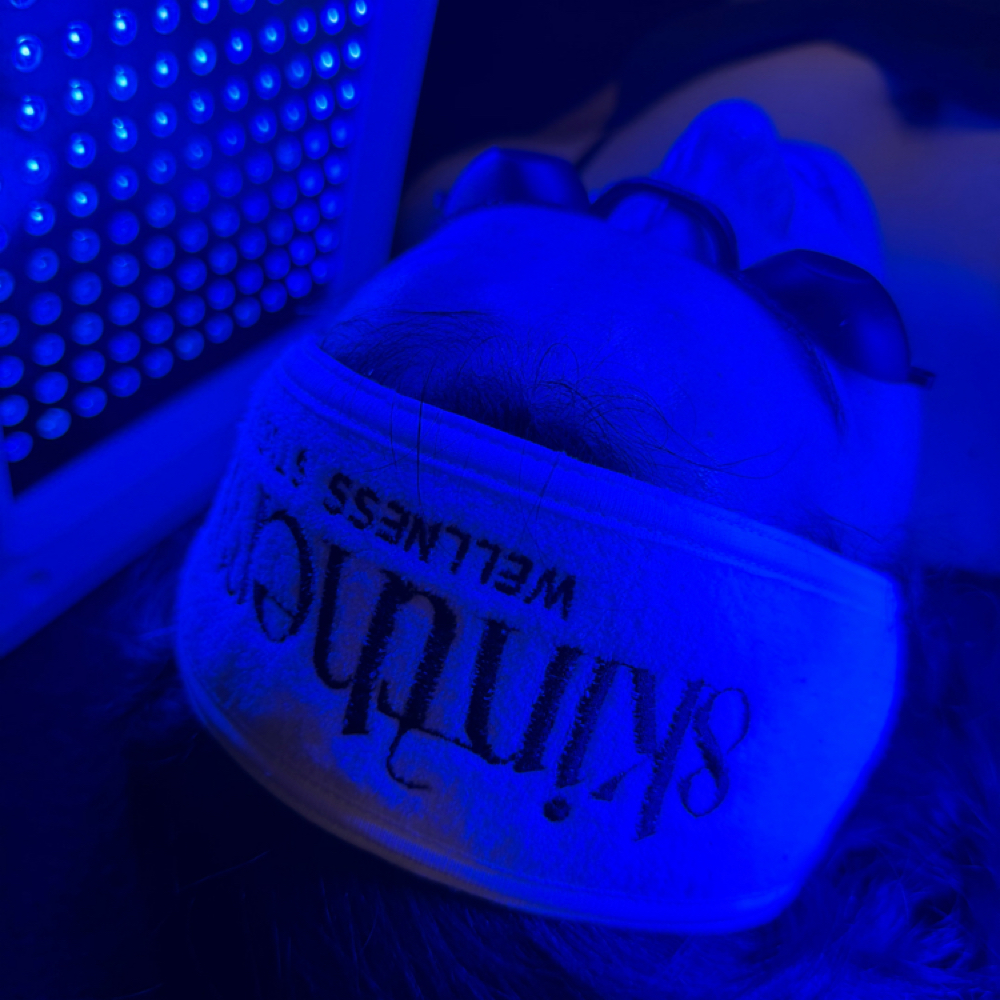 Acne Facials at Skin Therapy in Golden valley, MN