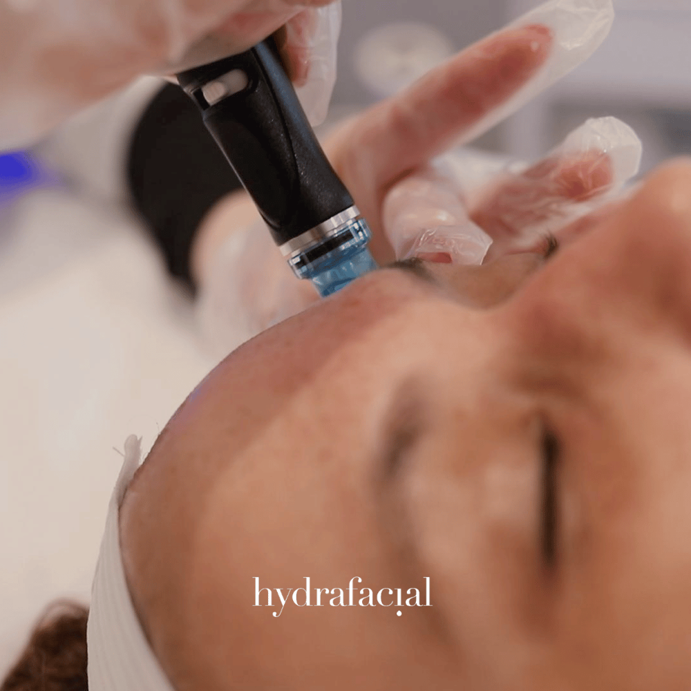 Deluxe Hydrafacial