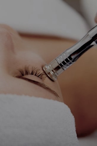 Microdermabrasion Facial