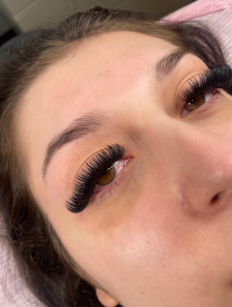Mega Volume Fill