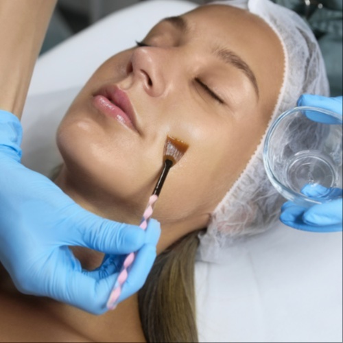 Glycolic Resurfacing Peel at Tracy WellBeing Retreat & Salon in Tracy, CA