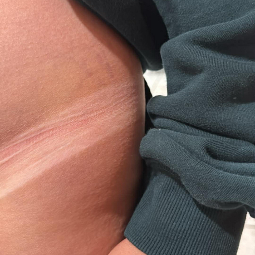 Rapid Heirloom Glow at Heirloom Beauty Co. in Clayton, GA