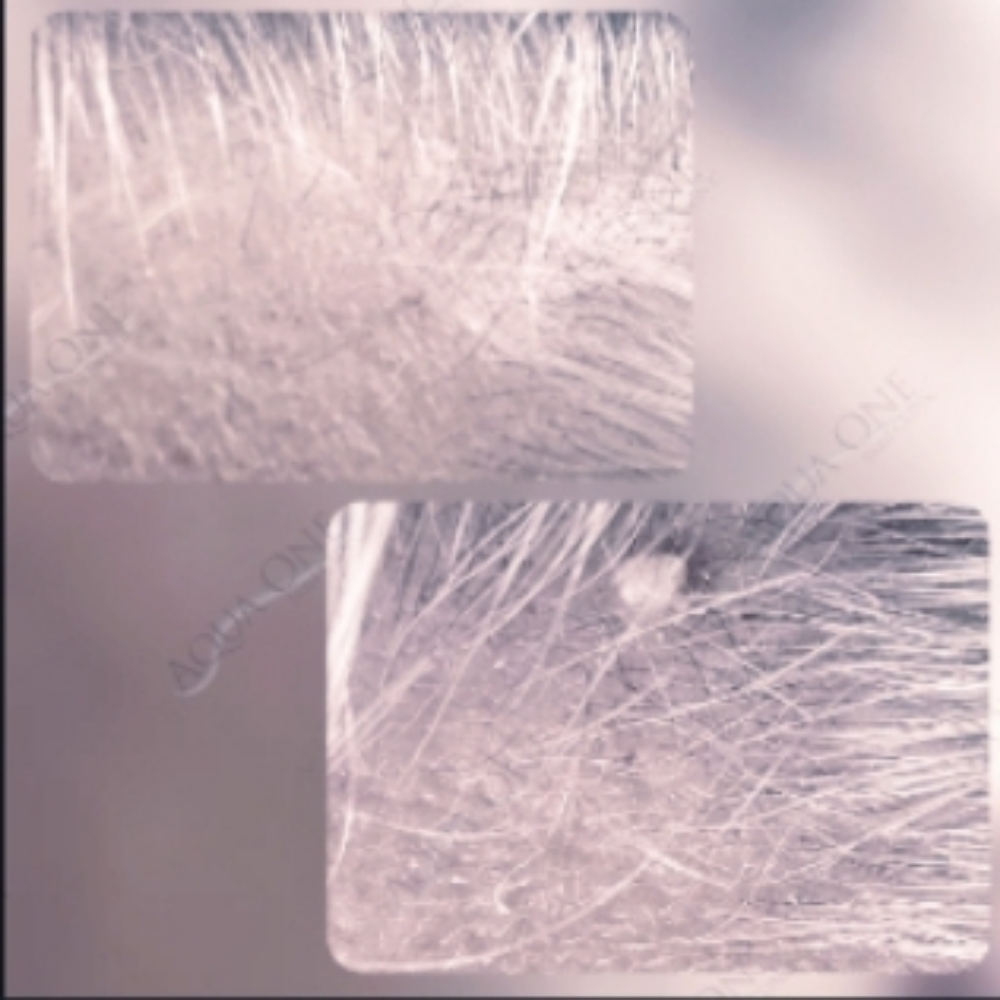 Brown Spot/Skin Tag- 2 at Aqua One Skin Clinic in Jasper, IN