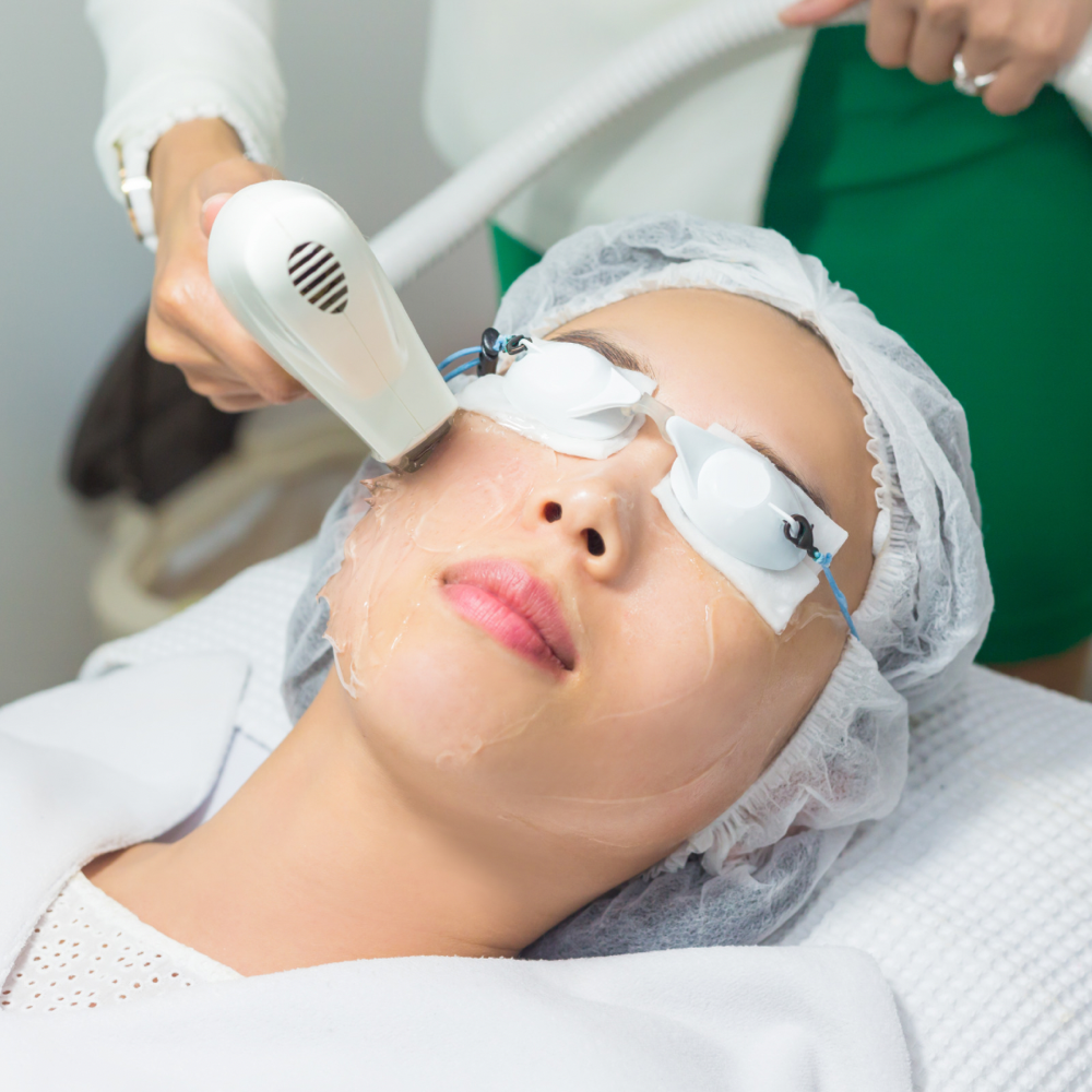 Intense Pulsed Light (IPL) Therapy