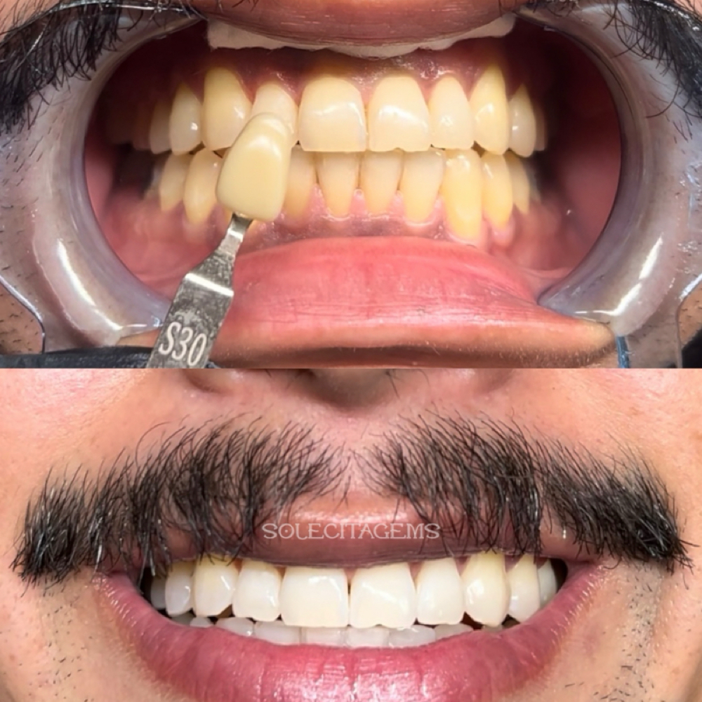 Beyond Ultra Whitening at Solecita Gems in Los Angeles, CA
