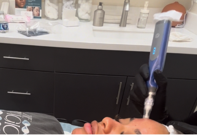 SkinPen Microneedling