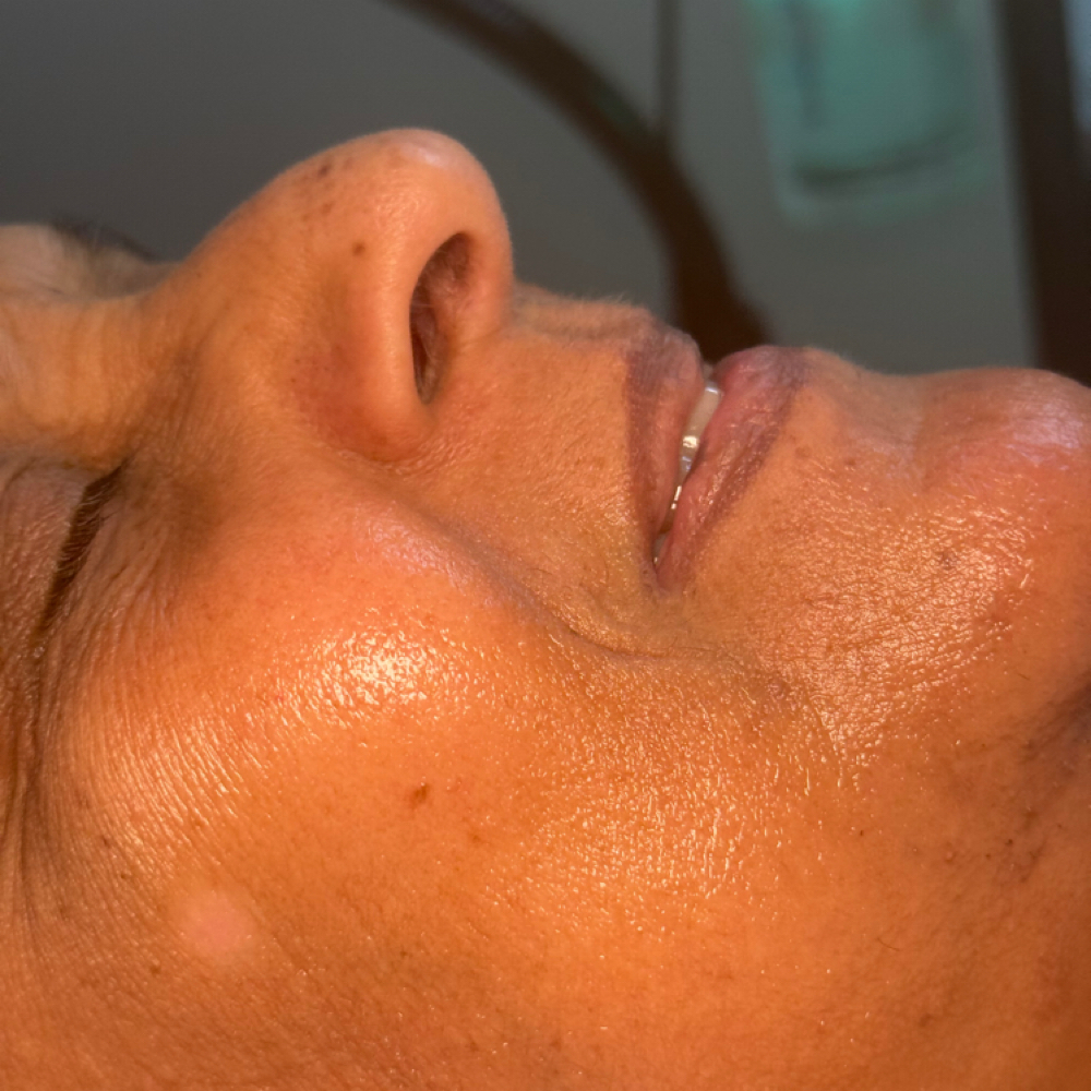 Age Renewal Facial