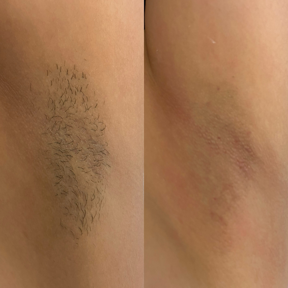 Under Arm Wax