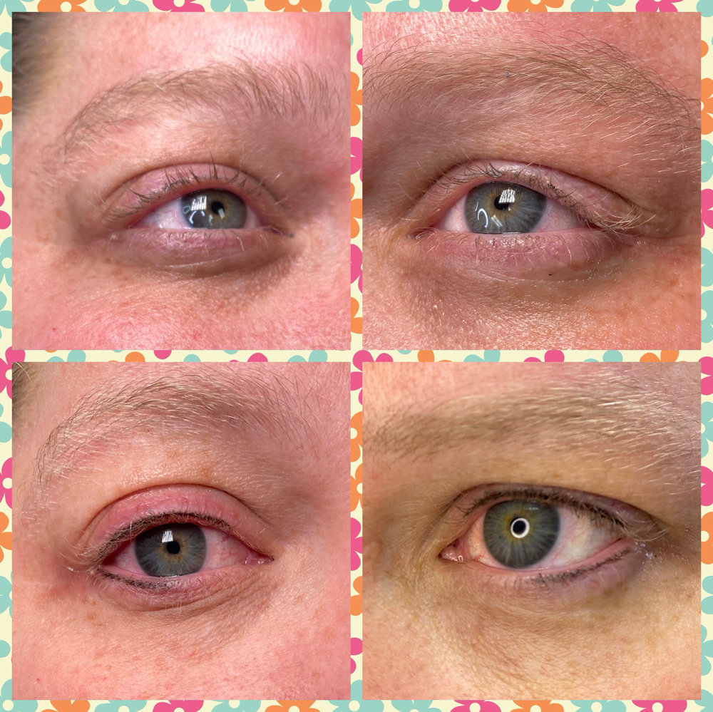 Top And Bottom Liner