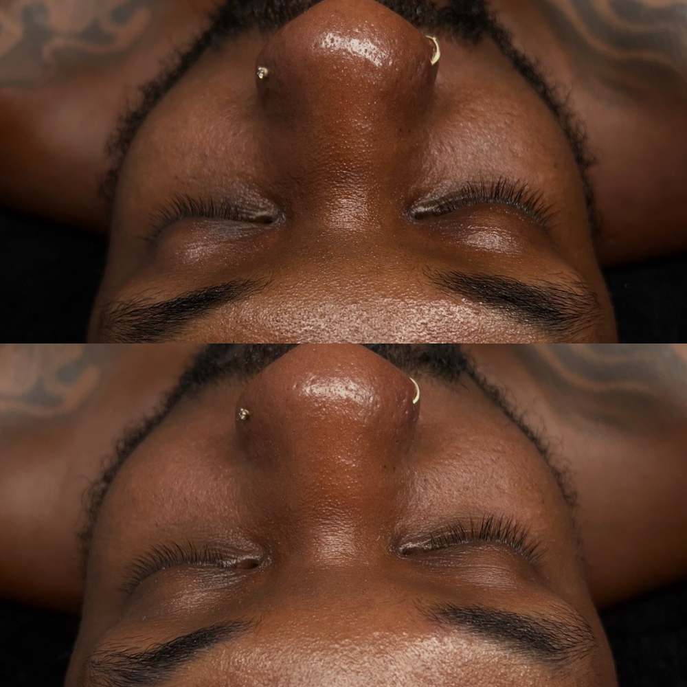Diamond Polish Facial at BB Aesthetics in Bakersfield, CA