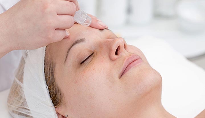 Microdermabrasion