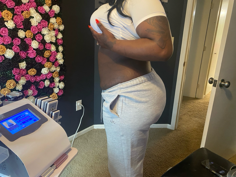 Meso Lipo Shots And Sculpting