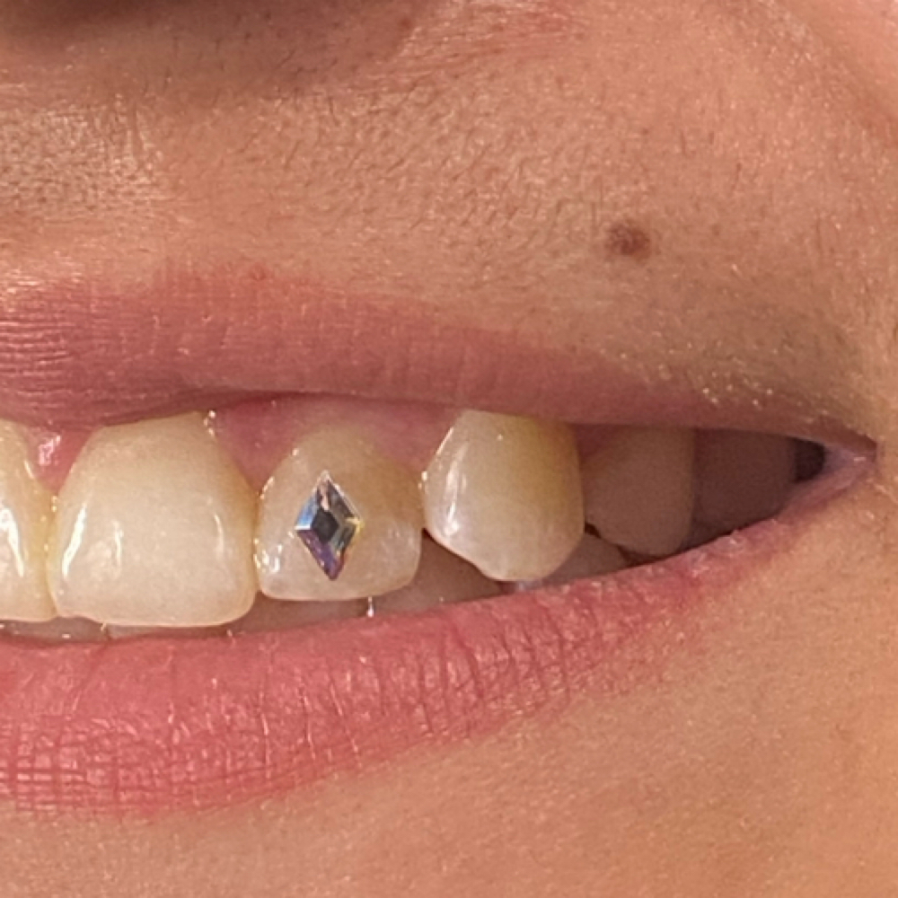 Tooth Gems at Stillwater esthetics in Elmer City, WA