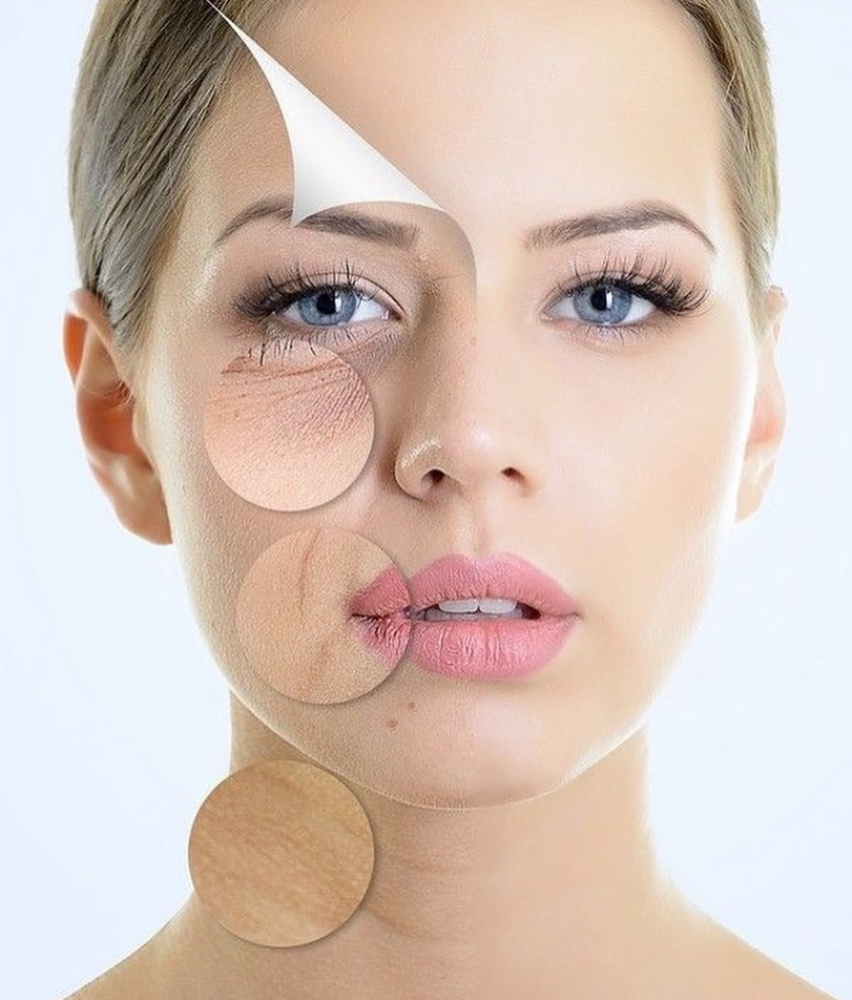 NO Filler Facial