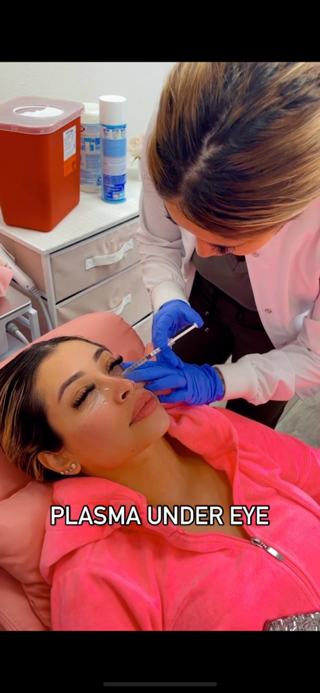 Under Eye Plasma