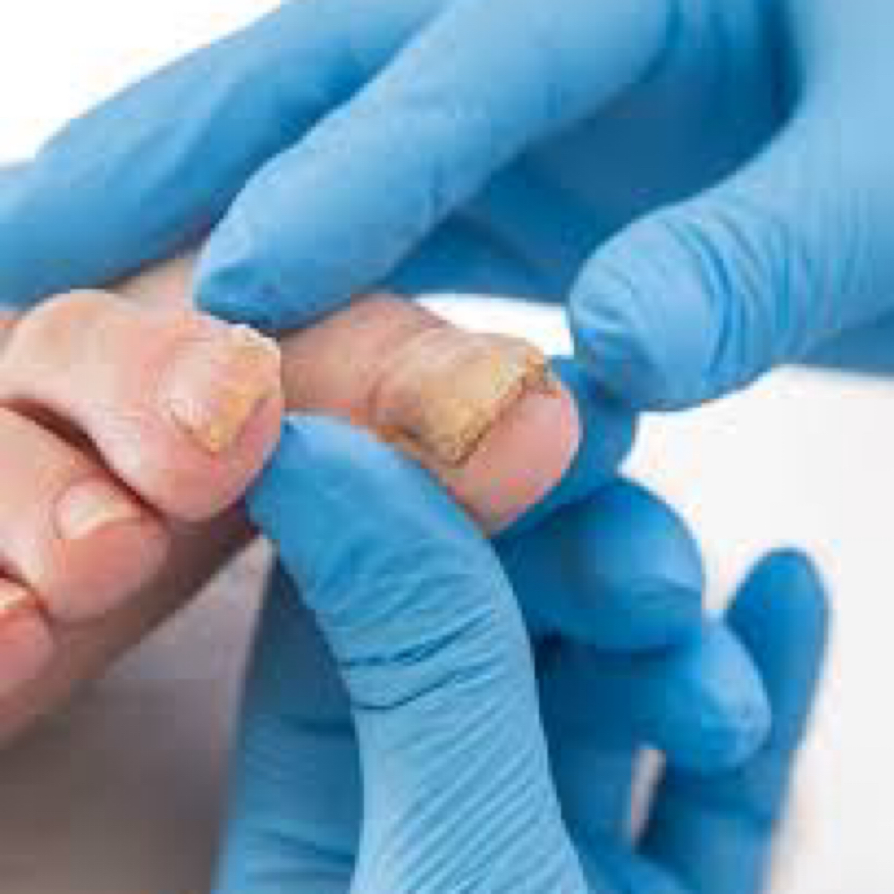 Medical Pedicure (medical) at The Nail Lab Nail Studios in Columbia, SC