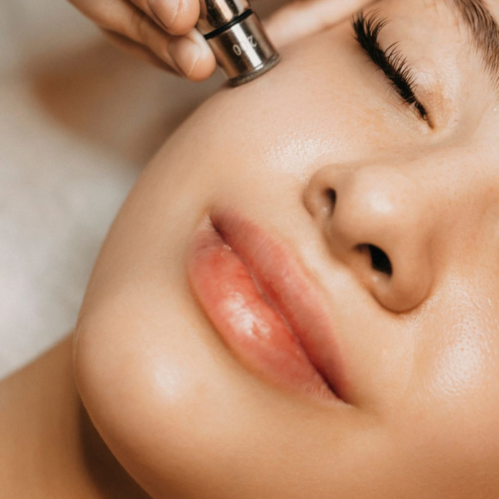 Add-on Microdermabrasion