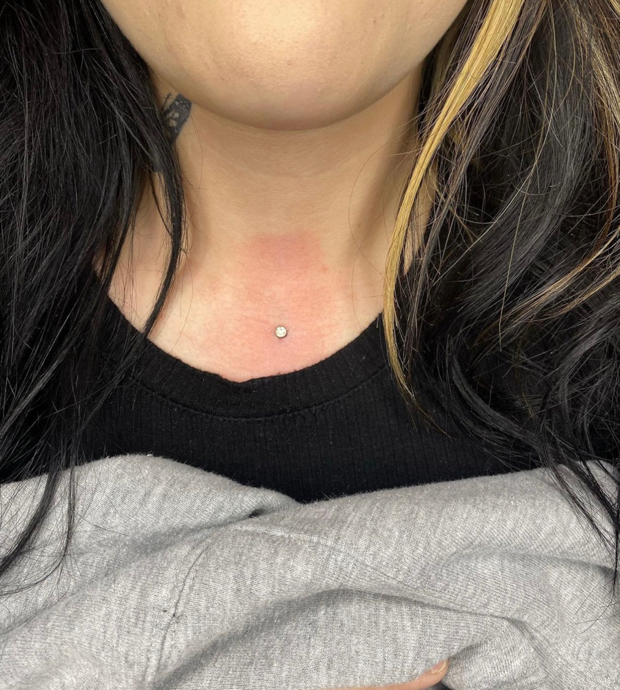 Chest Dermal